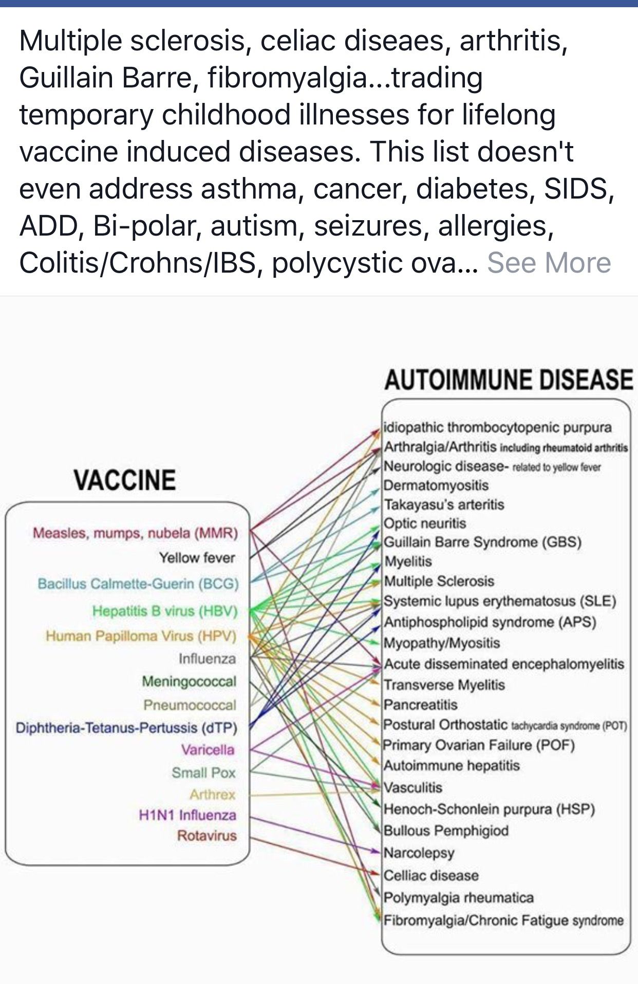 an example of an autoimmune disease is quizlet