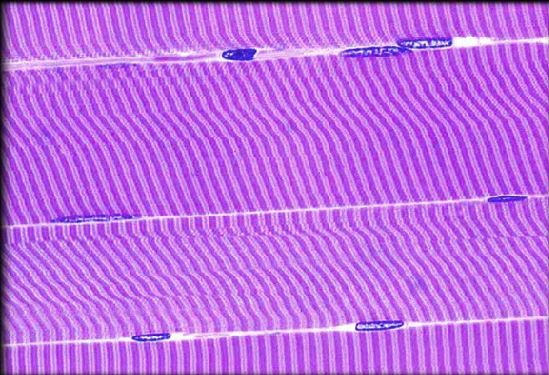 example of skeletal muscle tissue